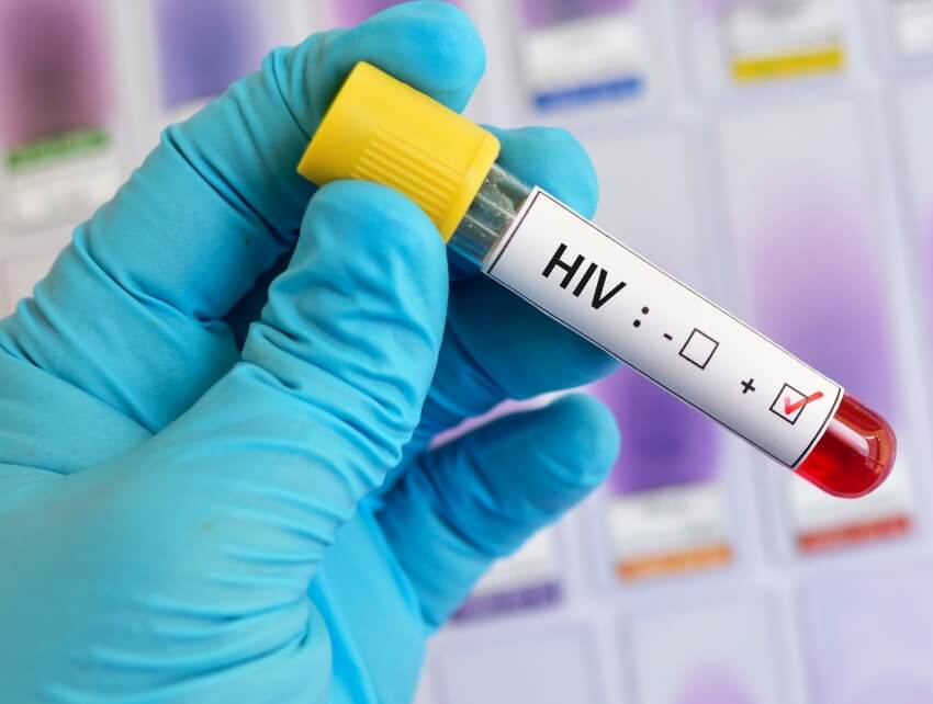 HIV checking tube