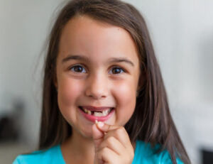 Cute Girl with a broken tooth - Brevard Health Alliance