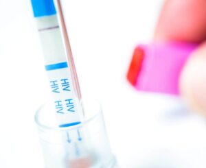 Person evaluating an At-home HIV test kit – Brevard Health Alliance