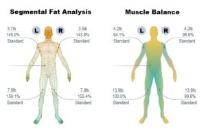 A chart showing percentages of fat and muscle in different areas of the body